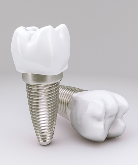 dental care in namakkal